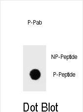 DB - Phospho-IKKB(S675) Antibody AP3782c